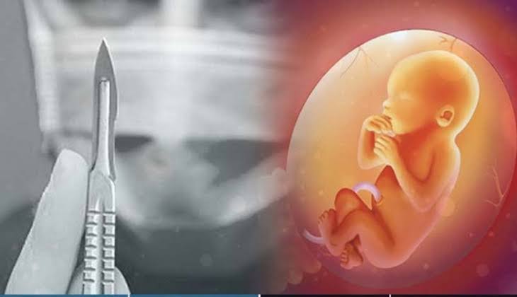 Keguguran dan Akhirnya Dicampakkan, Seorang Istri Sirih Polisi Laporkan Suaminya ke Polres Metro