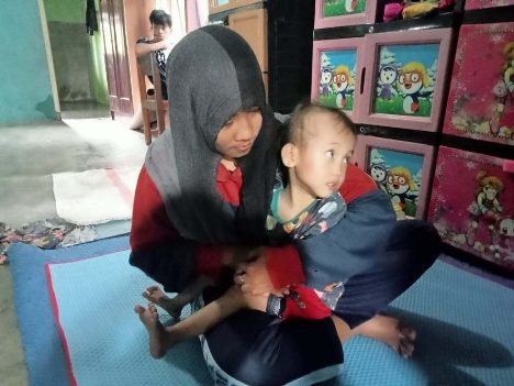 Anak 2,5 Tahun di Pesisir Barat Mengidap Kelainan Otak dan Kurang Gizi, Tidak Bisa Berobat Karena Kesulitan Ekonomi