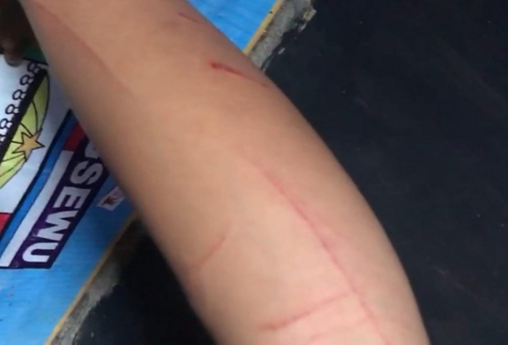 Dua ART di Lampung Diduga Dianiaya hingga Ditelanjangi oleh Majikannya Sendiri