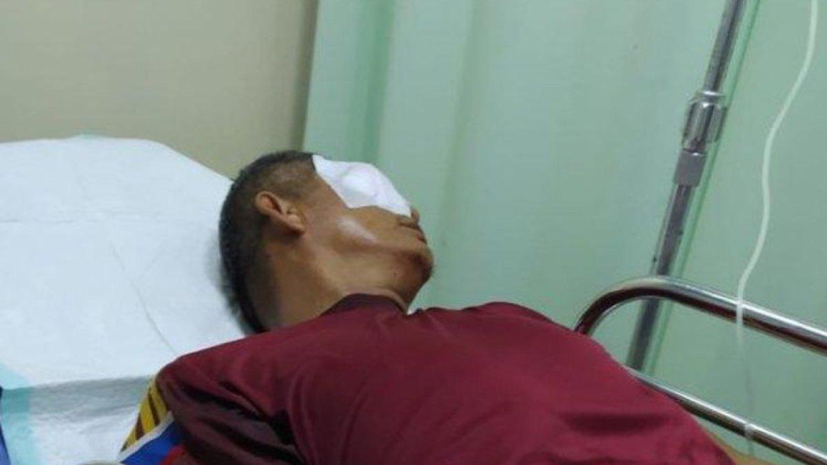 Tegur Murid karena Merokok, Guru di Bengkulu Malah Dikatapel Ortu Murid Hingga Bola Mata Rusak